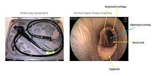 Endoscopy / Hystrescopy