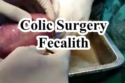 Colic Surgery – Fecalith