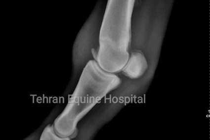 Subchondral Bone Fragment in fetlock joint
